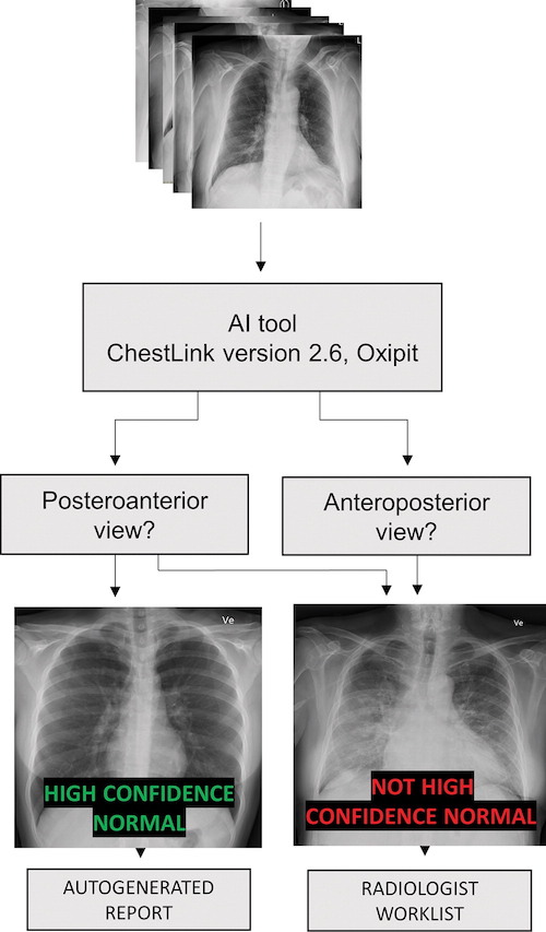 découvrez comment l'intelligence artificielle révolutionne le diagnostic médical, améliorant la précision et l'efficacité des soins de santé.